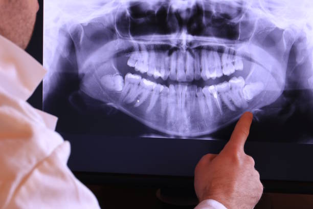 Best Broken or Cracked Tooth Emergency Dentist in Fort Campbell North, KY