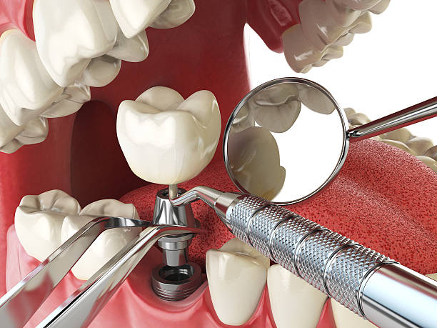 Best Pediatric Emergency Dentist in Fort Campbell North, KY